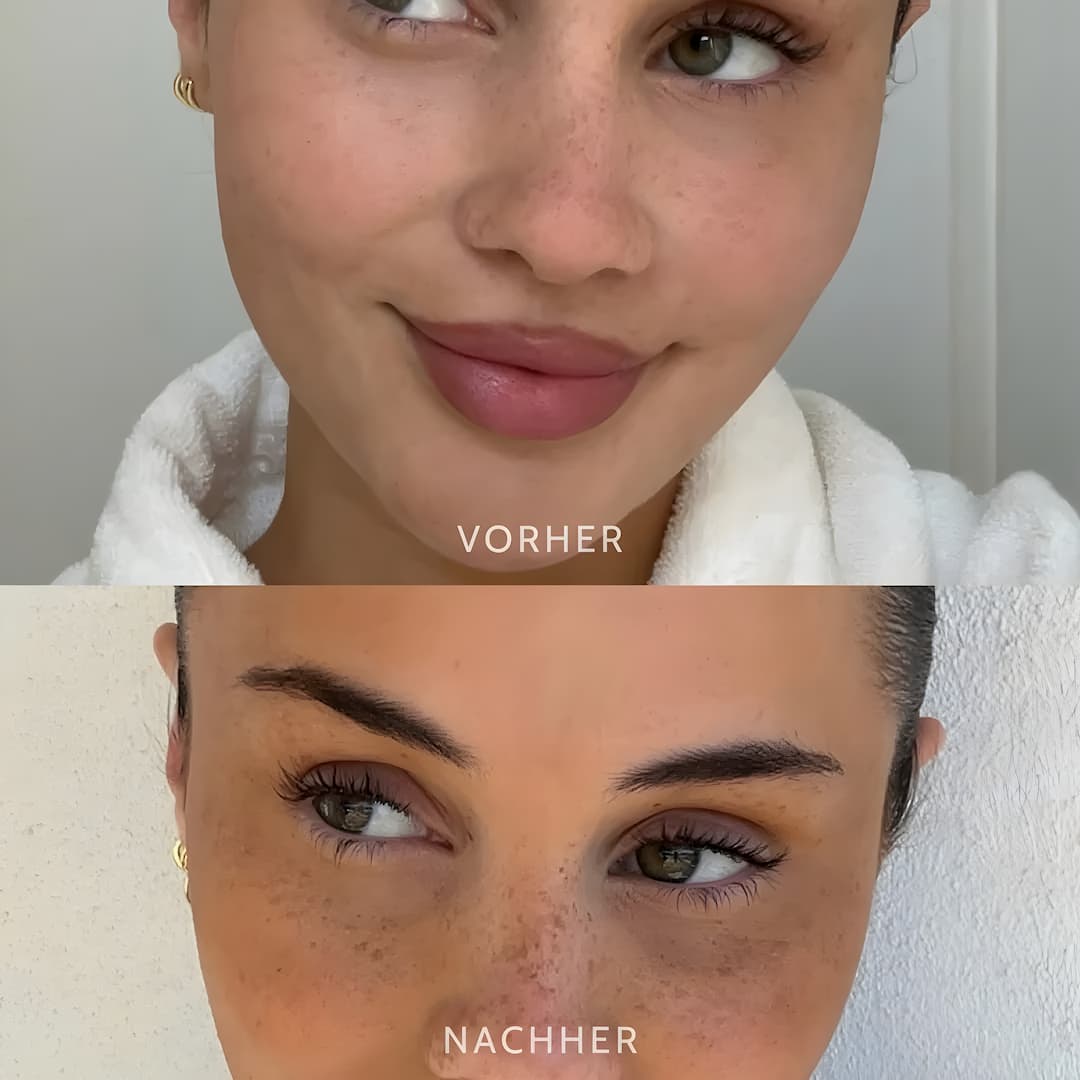 Sunli™ | FreckleStamp