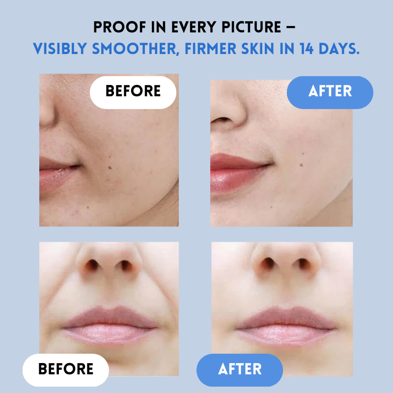 LiftDefine® | Anti-Aging-Strip