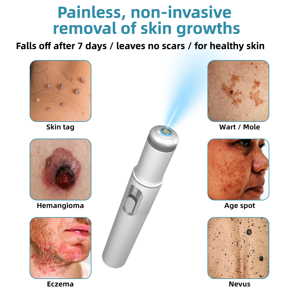 Dermiq™ | Mole and Wart Removal Laser Pen Promax