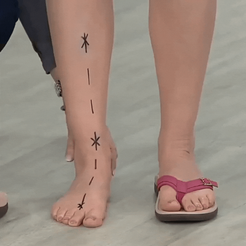 Novelloo | Orthopedic sandals