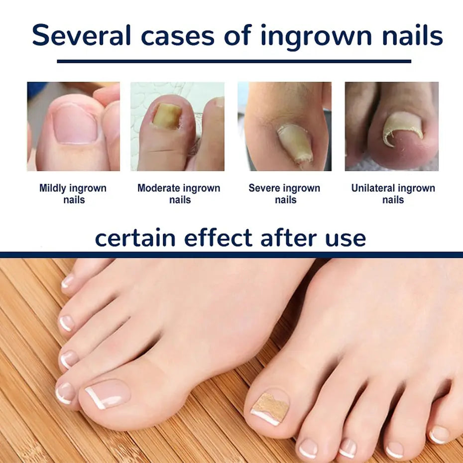 NailRevive™ | Beautiful, Healthy Nails! (50 Pieces), trengthen, Nourish, Shine – Nails That Speak Confidence!