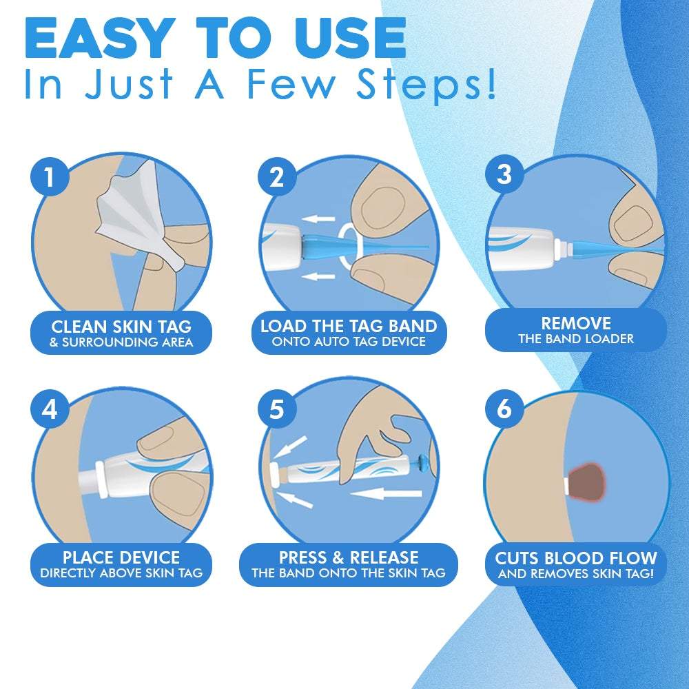 FlawFix™  | stalk wart removal kit