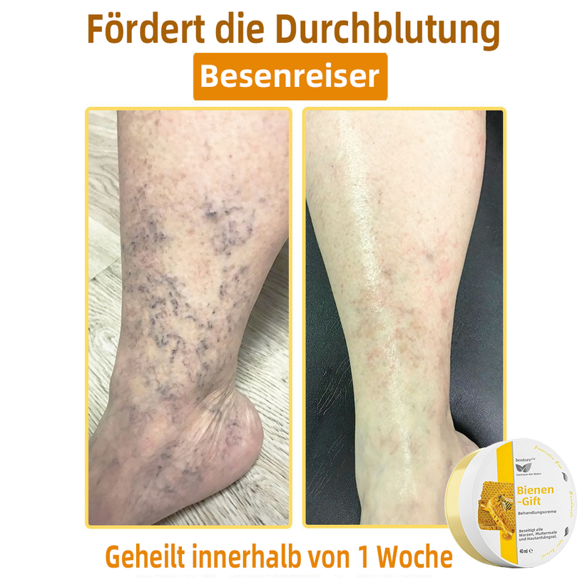 Venovia™ | Natural skin solution