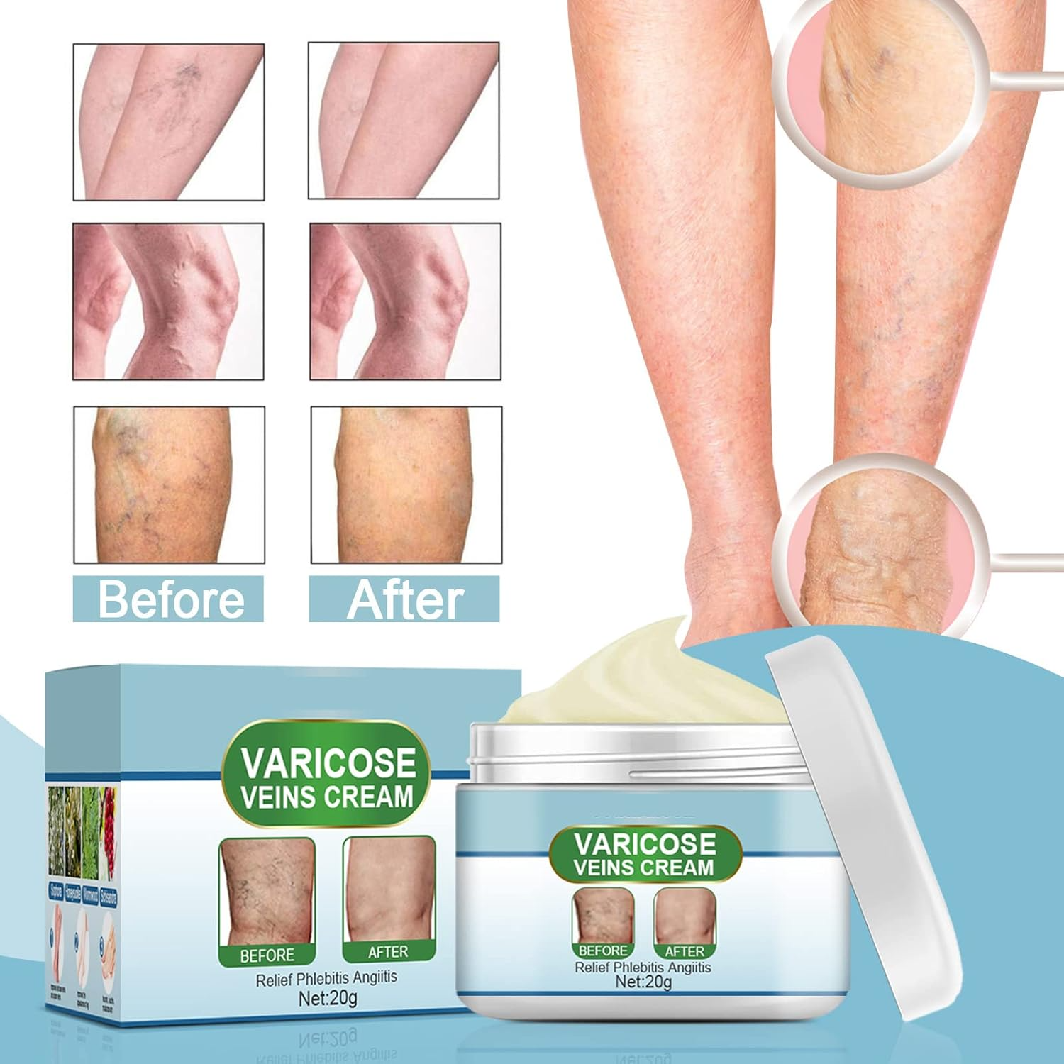Veiniva™ | Vein relief cream