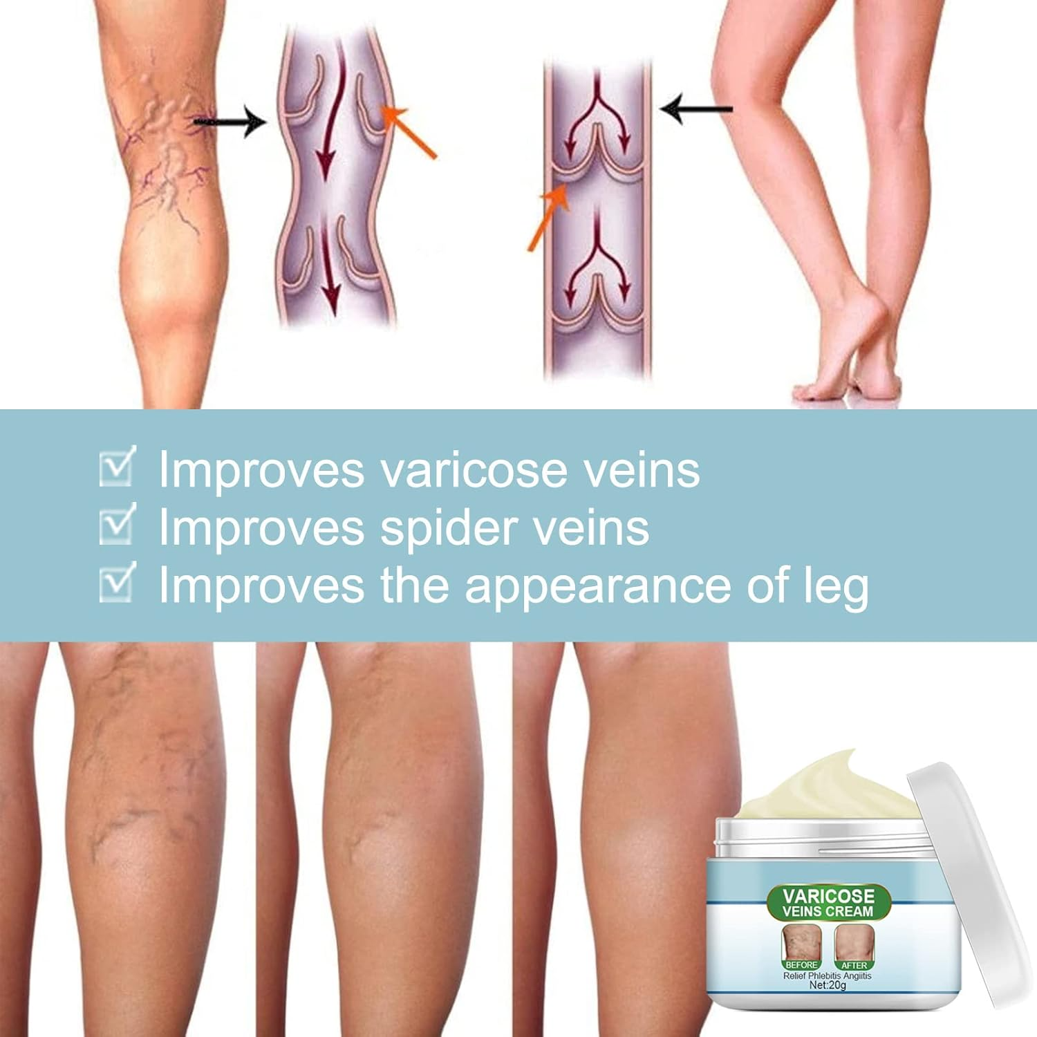 Veiniva™ | Vein relief cream