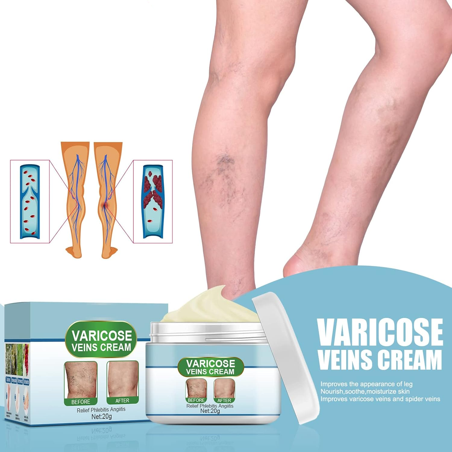 Veiniva™ | Vein relief cream