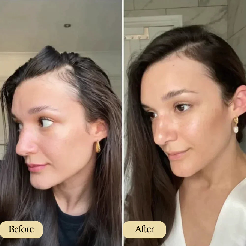 1+1 FREE | RootRevive™ | Your Natural Oil Treatment for Hair Growth, Restore, Strengthen, and Revive Your Hair Naturally!