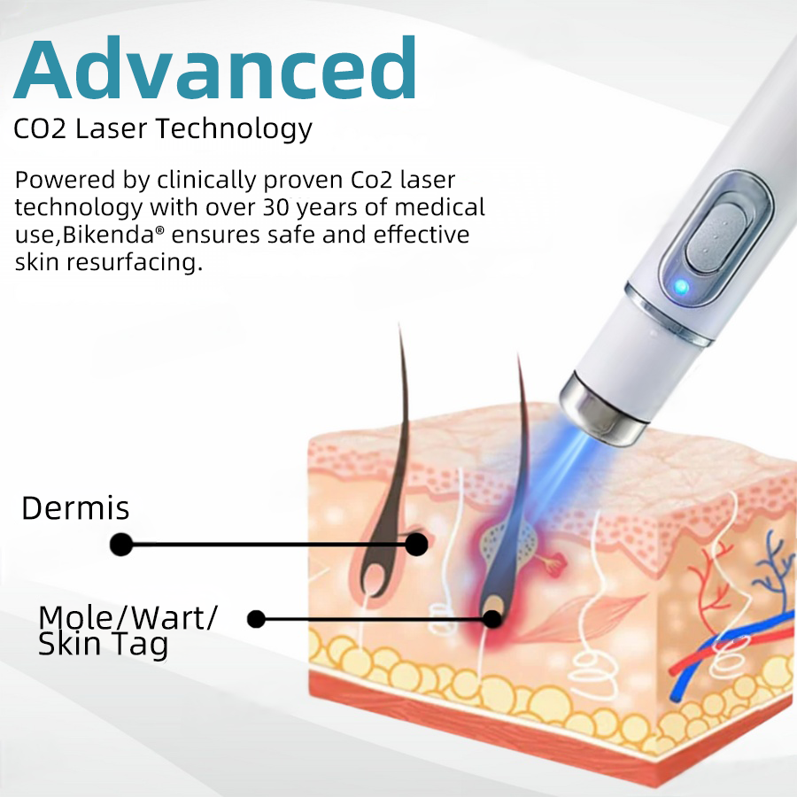 Dermiq™ | Mole and Wart Removal Laser Pen Promax