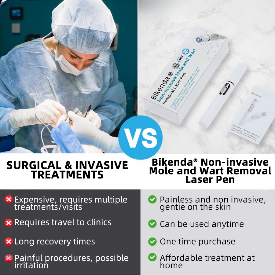 Dermiq™ | Mole and Wart Removal Laser Pen Promax