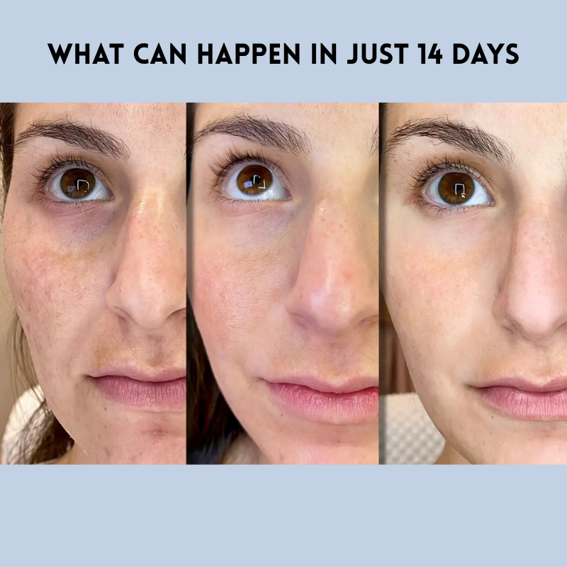 LiftDefine® | Anti-Aging-Strip