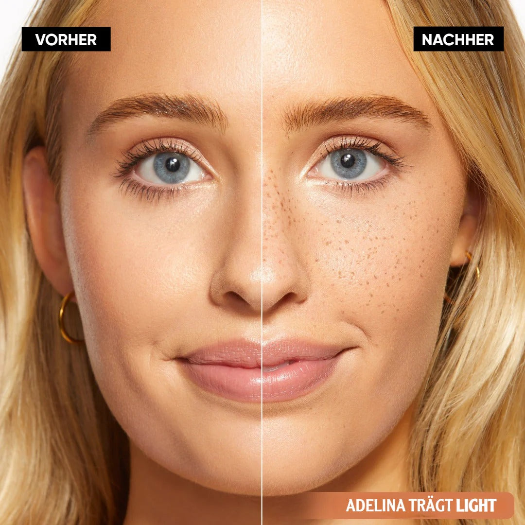 Sunli™ | FreckleStamp