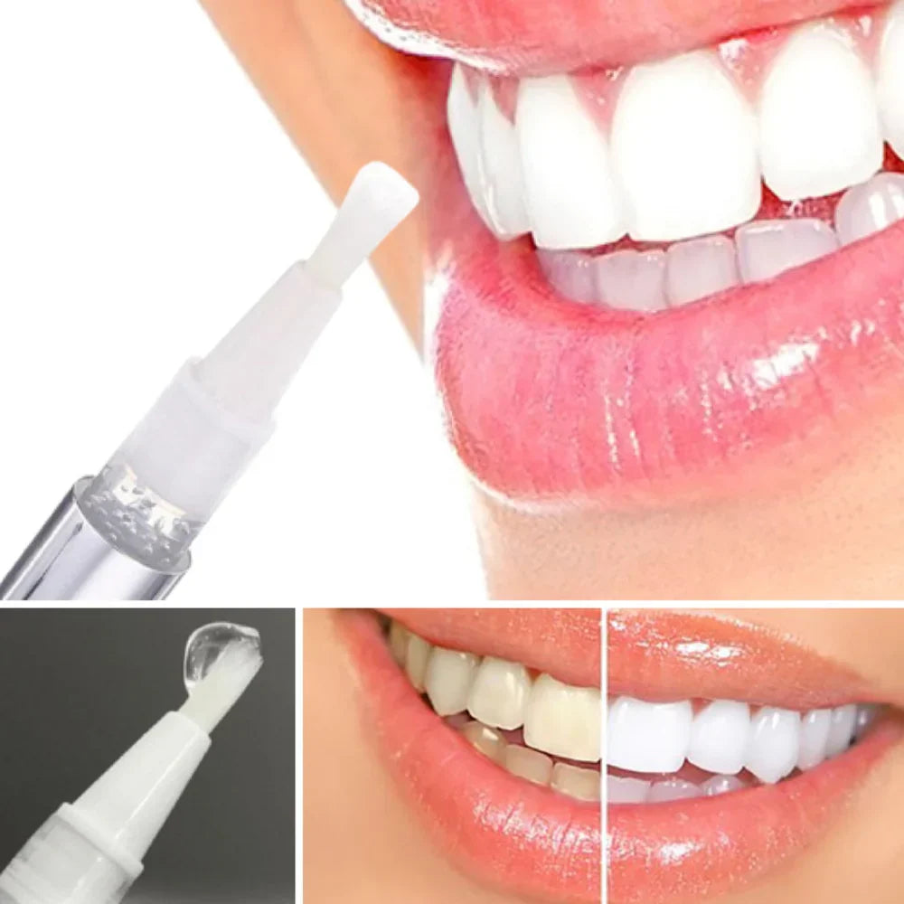 RadiantSmile® | Instant Teeth Whitener