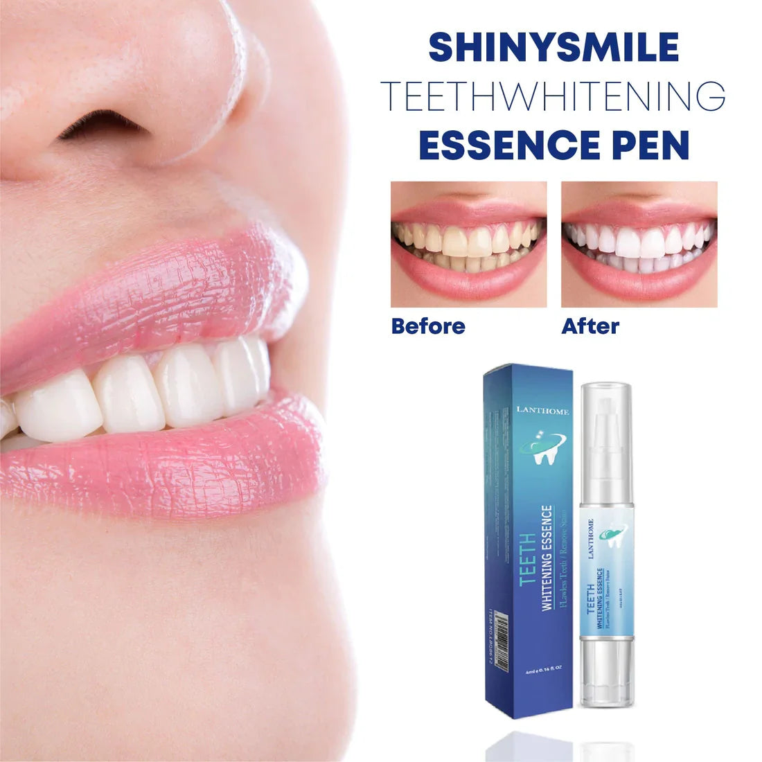 1+1 FREE l SHINYSMILE™ | Instant brightness, lasting confidence, Say Goodbye to Stains, Hello to Confidence!