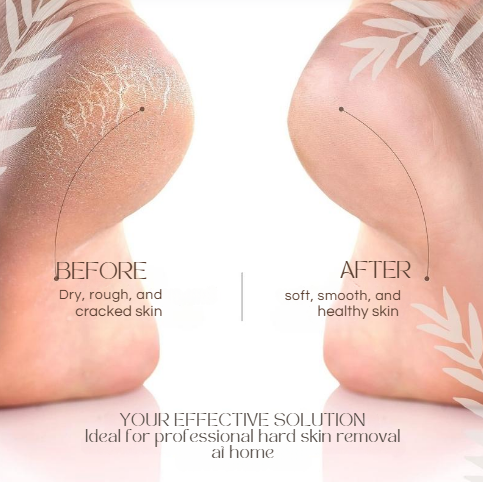 SilkFeet™ | Smoothness You Can Feel, Confidence You Can Show!