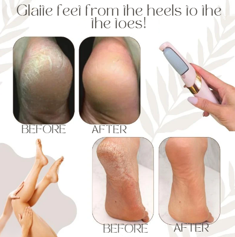 SilkFeet™ | Smoothness You Can Feel, Confidence You Can Show!