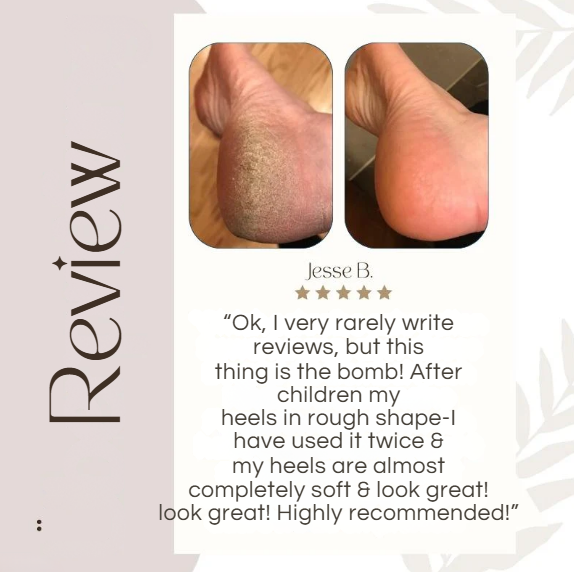 SilkFeet™ | Smoothness You Can Feel, Confidence You Can Show!