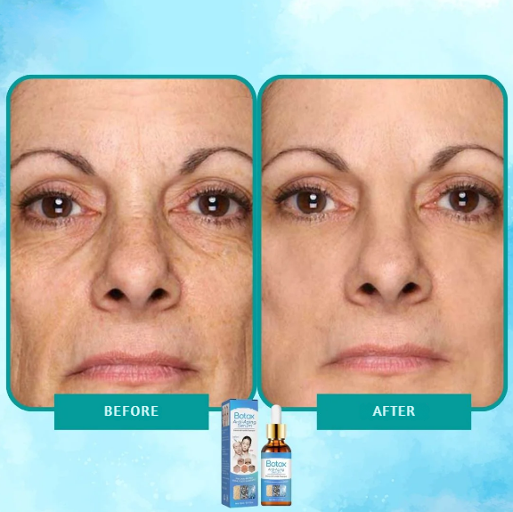 1+1 FREE | PureYouth™ | Botox Anti-Aging Serum, Erase Wrinkles, Reveal Your Best Skin!