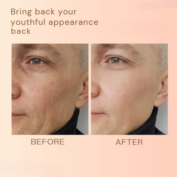 1+1 FREE | Revitaline™ | Skin Renewal Balm Against Wrinkles