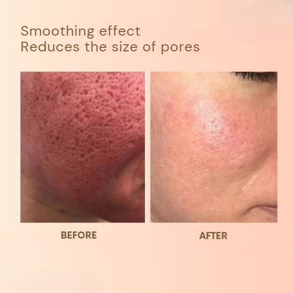 1+1 FREE | Revitaline™ | Skin Renewal Balm Against Wrinkles