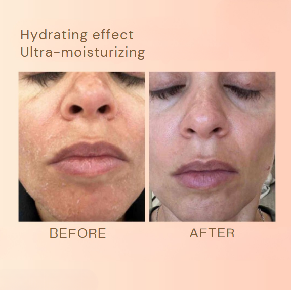 1+1 FREE | Revitaline™ | Skin Renewal Balm Against Wrinkles