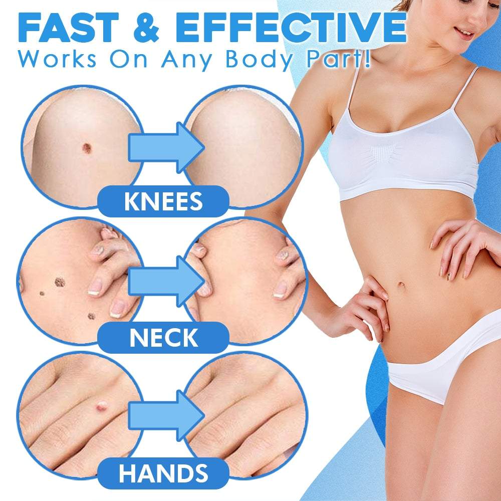 FlawFix™  | stalk wart removal kit