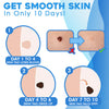50% OFF | FlawFix™  | stalk wart removal kit