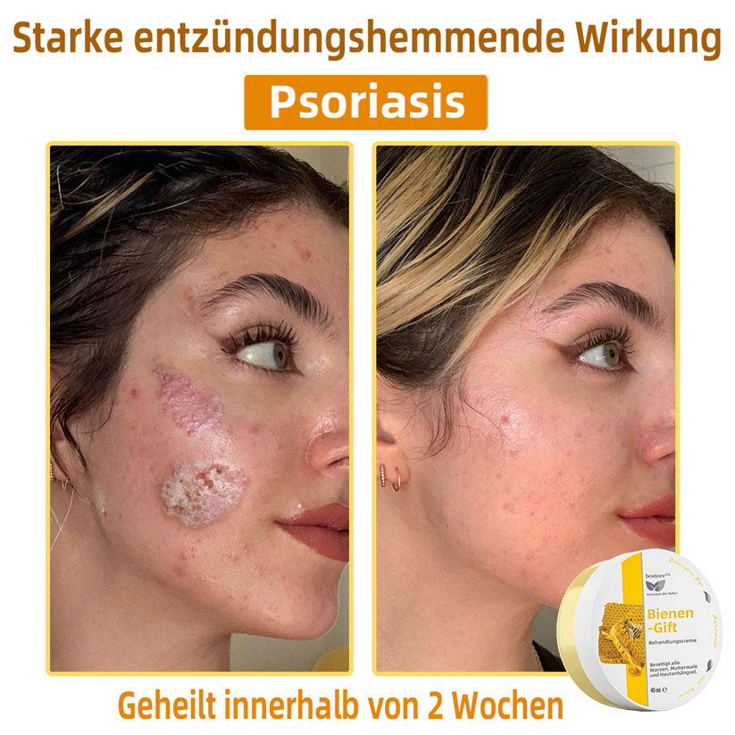 Venovia™ | Natural skin solution