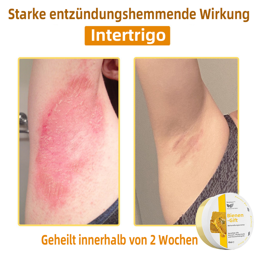 Venovia™ | Natural skin solution