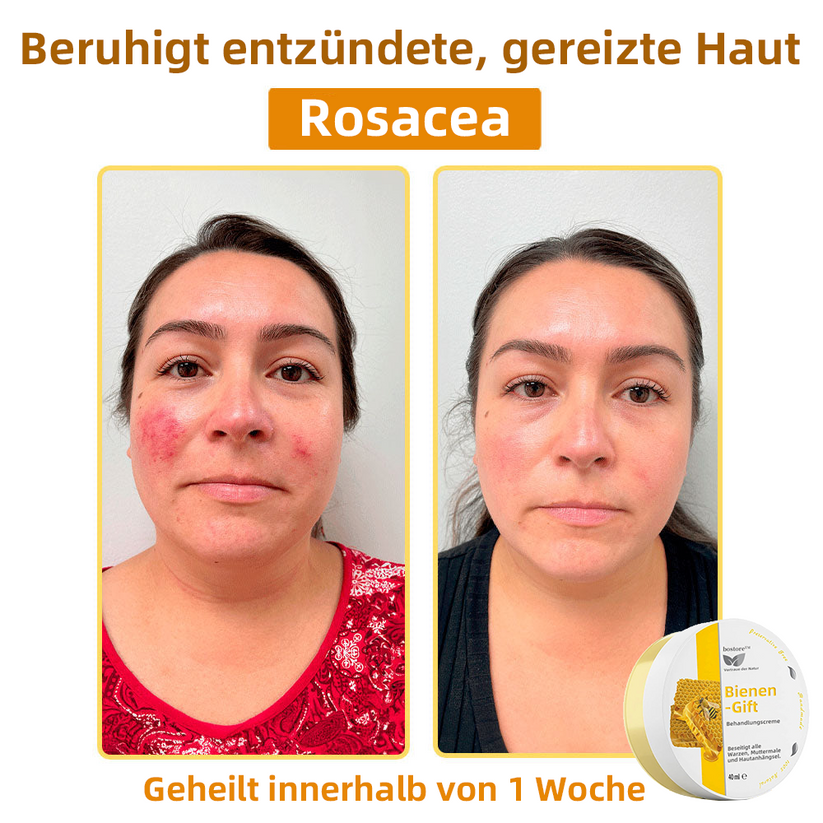 Venovia™ | Natural skin solution