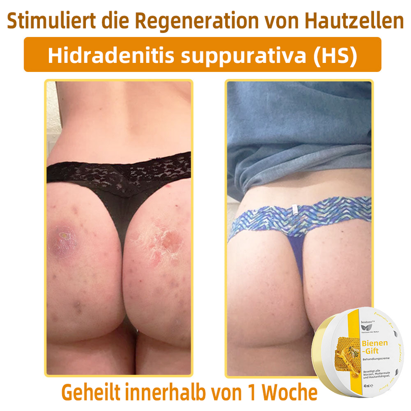 Venovia™ | Natural skin solution