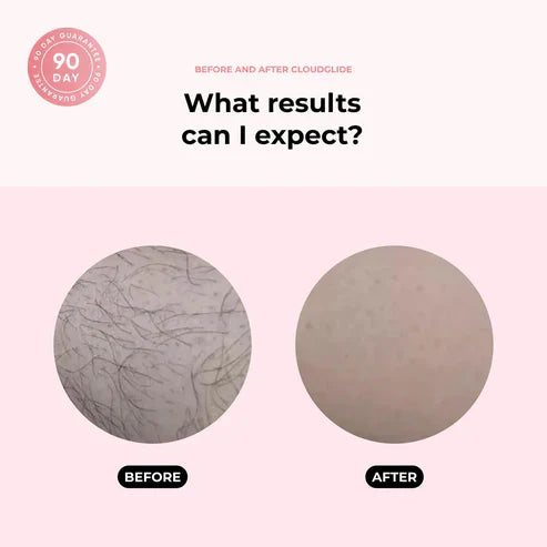 ZenTrimmer™ | 2-in1 Shaver, Smooth skin in seconds!