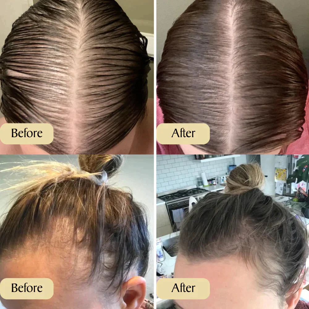 1+1 FREE | RootRevive™ | Your Natural Oil Treatment for Hair Growth, Restore, Strengthen, and Revive Your Hair Naturally!