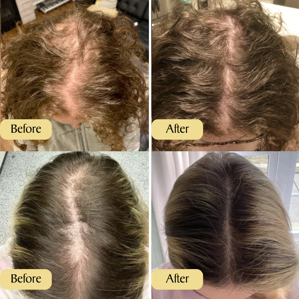 1+1 FREE | RootRevive™ | Your Natural Oil Treatment for Hair Growth, Restore, Strengthen, and Revive Your Hair Naturally!