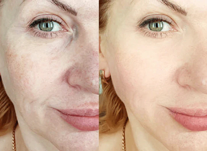 Buy 1 Get 1 Free | RadianceRoot™ | Dark Spot Correction, Say Goodbye to Dark Spots and Hello to Flawless Skin!